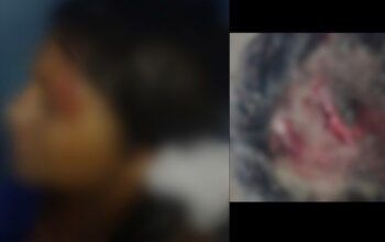 Após negar relação Sexual, marido agride esposa e foge levando criança de 2 anos em Candeias do Jamari