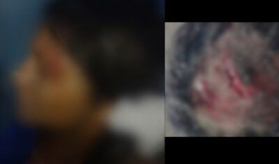 Após negar relação Sexual, marido agride esposa e foge levando criança de 2 anos em Candeias do Jamari