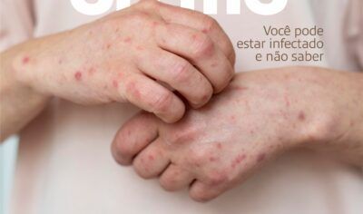 Jaru: Clin Med orienta sobre sífilis e reforça importância do exame