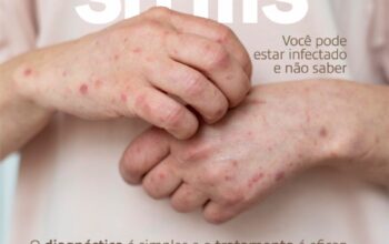 Clin Med Jaru chama atenção para prevenção e tratamento da Sifilis