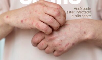 Clin Med Jaru chama atenção para prevenção e tratamento da Sifilis