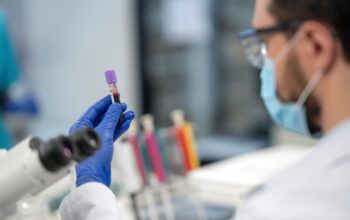 Agendamento via Whatsapp de exames laboratoriais pelo SUS em Jaru começa a valer a partir de 1º de agosto