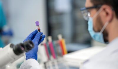 Agendamento via Whatsapp de exames laboratoriais pelo SUS em Jaru começa a valer a partir de 1º de agosto