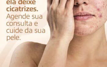 Acne, manchas e doenças da pele: ClinMed atende com o dermatologista Dr. Lucas Leonardo