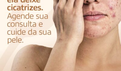 Acne, manchas e doenças da pele: ClinMed atende com o dermatologista Dr. Lucas Leonardo