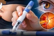 Anvisa investiga 13 casos suspeitos de doença rara nos olhos entre usuários de canetas emagrecedoras