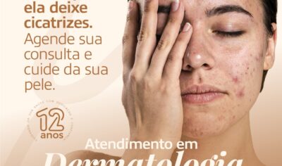 Acne tem tratamento: Dr. Lucas Leonardo realiza atendimento em Dermatologia na Clin Med Jaru